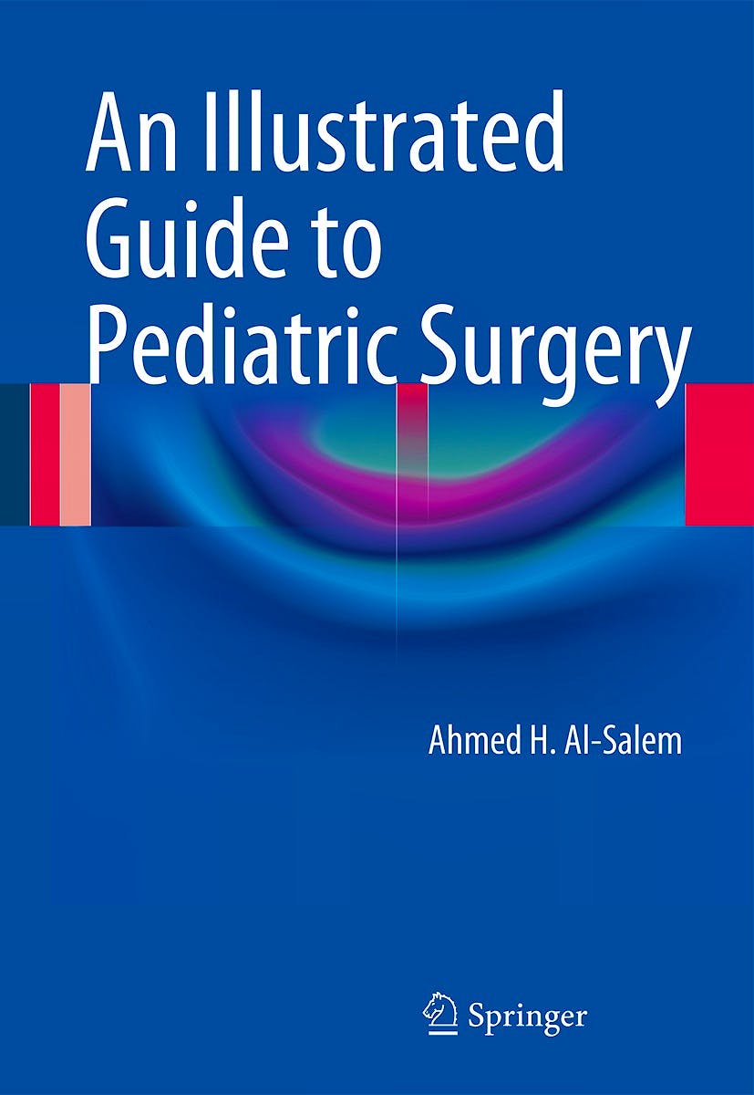 Portada del libro 9783319066646 An Illustrated Guide to Pediatric Surgery