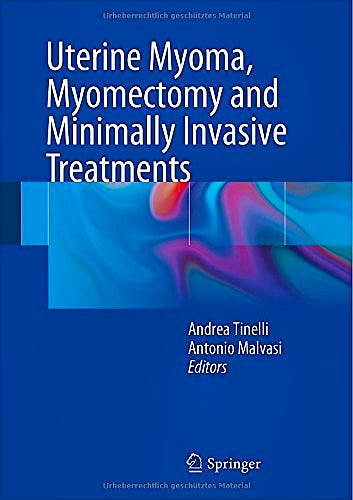 Portada del libro 9783319103044 Uterine Myoma, Myomectomy and Minimally Invasive Treatments