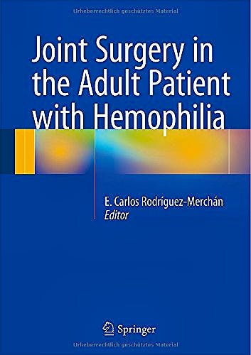 Portada del libro 9783319107790 Joint Surgery in the Adult Patient with Hemophilia