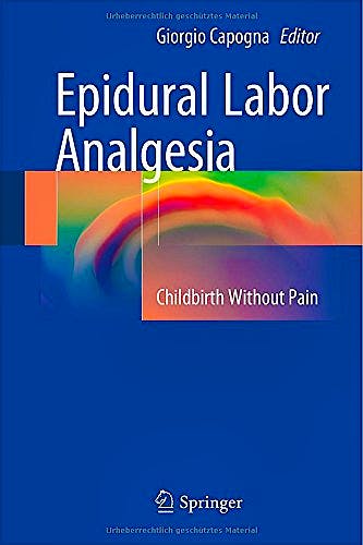 Portada del libro 9783319138893 Epidural Labor Analgesia. Childbirth without Pain