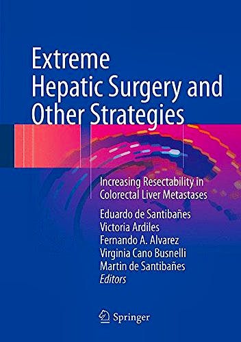 Portada del libro 9783319138954 Extreme Hepatic Surgery and Other Strategies