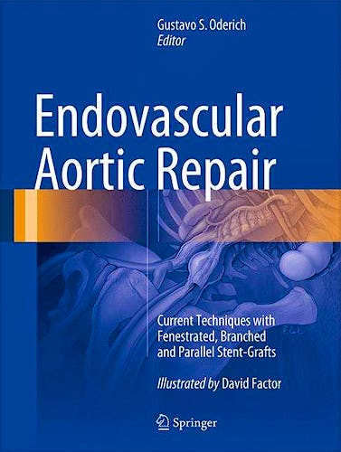 Portada del libro 9783319151915 Endovascular Aortic Repair. Current Techniques with Fenestrated, Branched and Parallel Stent-Grafts