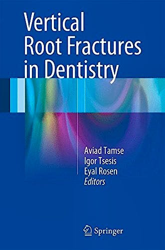 Portada del libro 9783319168463 Vertical Root Fractures in Dentistry