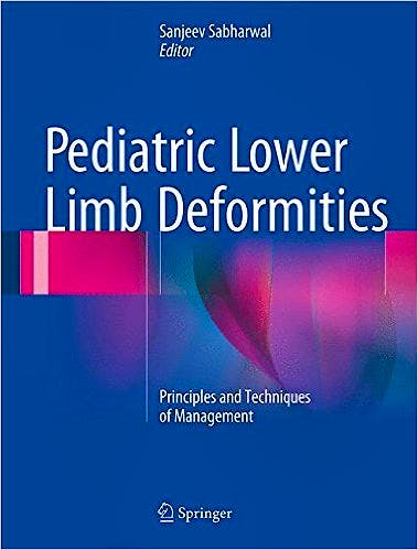 Portada del libro 9783319170961 Pediatric Lower Limb Deformities. Principles and Techniques of Management