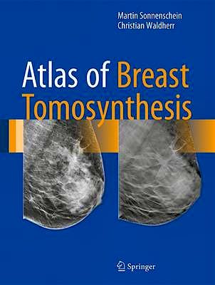 Portada del libro 9783319215655 Atlas of Breast Tomosynthesis. Imaging Findings and Image-Guided Interventions