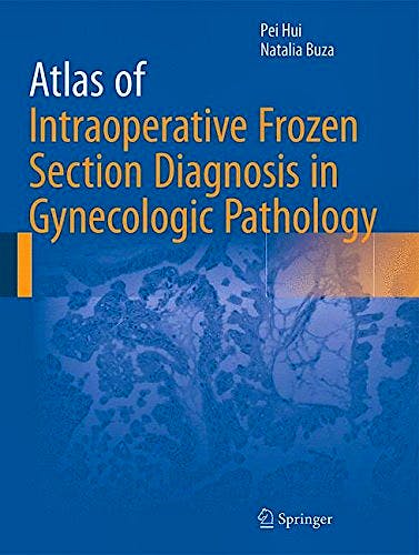 Portada del libro 9783319218069 Atlas of Intraoperative Frozen Section Diagnosis in Gynecologic Pathology