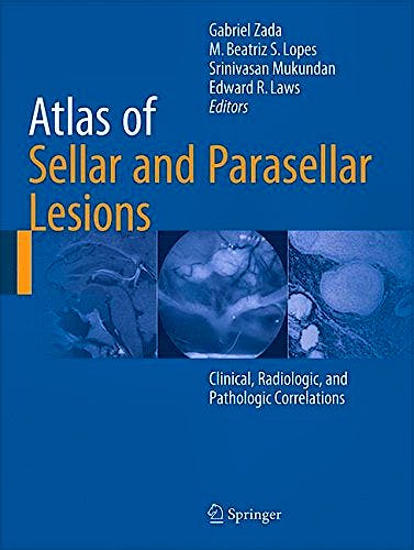 Portada del libro 9783319228549 Atlas of Sellar and Parasellar Lesions. Clinical, Radiologic, and Pathologic Correlations