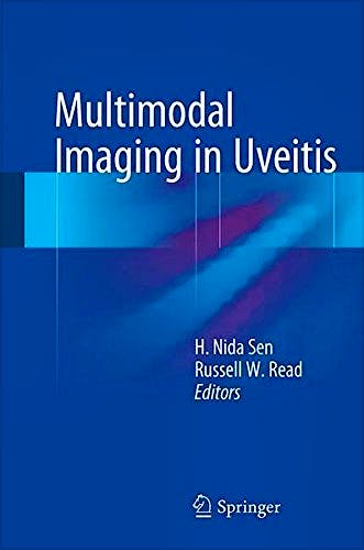 Multimodal Imaging in Uveitis