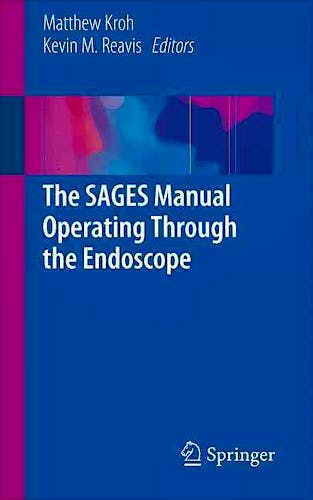 Portada del libro 9783319241432 The Sages Manual Operating through the Endoscope