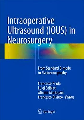 Portada del libro 9783319252667 Intraoperative Ultrasound (IOUS) in Neurosurgery. From Standard B-Mode to Elastosonography