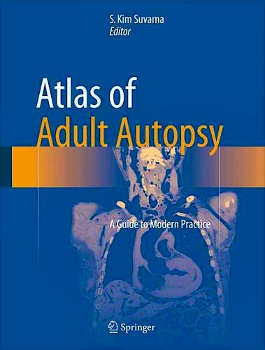 Portada del libro 9783319270203 Atlas of Adult Autopsy. a Guide to Modern Practice