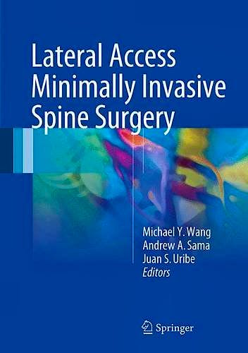 Portada del libro 9783319283180 Lateral Access Minimally Invasive Spine Surgery (Hardcover)