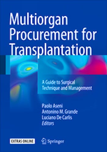 Portada del libro 9783319284149 Multiorgan Procurement for Transplantation. A Guide to Surgical Technique and Management