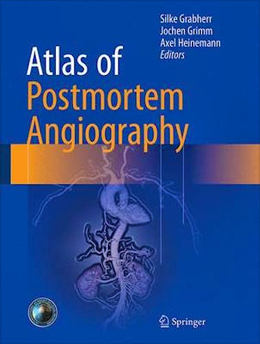 Portada del libro 9783319285351 Atlas of Postmortem Angiography