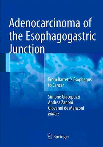 Portada del libro 9783319287744 Adenocarcinoma of the Esophagogastric Junction. from Barrett's Esophagus to Cancer