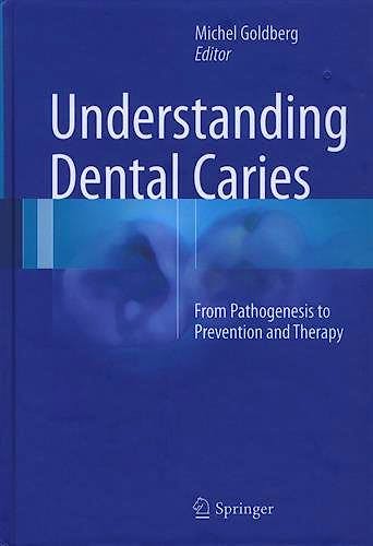 Portada del libro 9783319305509 Understanding Dental Caries. from Pathogenesis to Prevention and Therapy