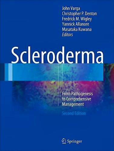 Portada del libro 9783319314051 Scleroderma. from Pathogenesis to Comprehensive Management