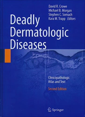 Portada del libro 9783319315645 Deadly Dermatologic Diseases. Clinicopathologic Atlas and Text