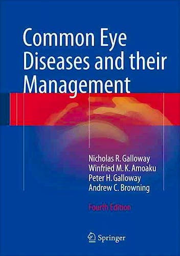 Portada del libro 9783319328676 Common Eye Diseases and Their Management