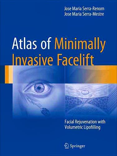 Portada del libro 9783319330167 Atlas of Minimally Invasive Facelift. Facial Rejuvenation with Volumetric Lipofilling