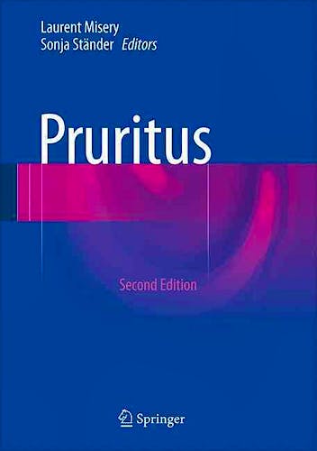 Portada del libro 9783319331409 Pruritus
