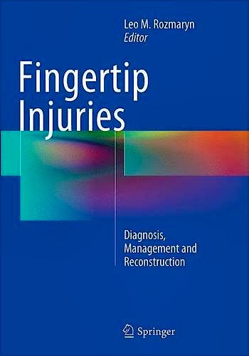 Portada del libro 9783319353760 Fingertip Injuries. Diagnosis, Management and Reconstruction