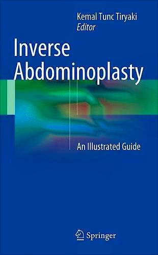 Portada del libro 9783319393087 Inverse Abdominoplasty. An Illustrated Guide