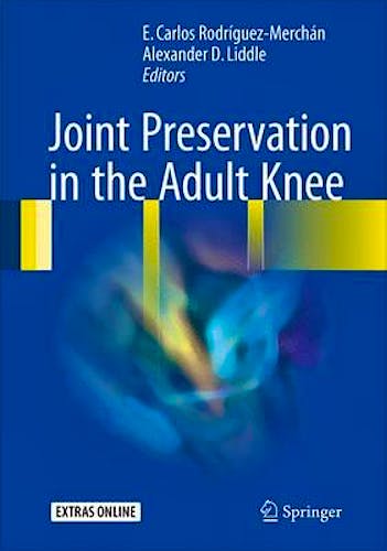 Portada del libro 9783319418070 Joint Preservation in the Adult Knee
