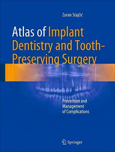 Portada del libro 9783319421223 Atlas of Implant Dentistry and Tooth-Preserving Surgery. Prevention and Management of Complications