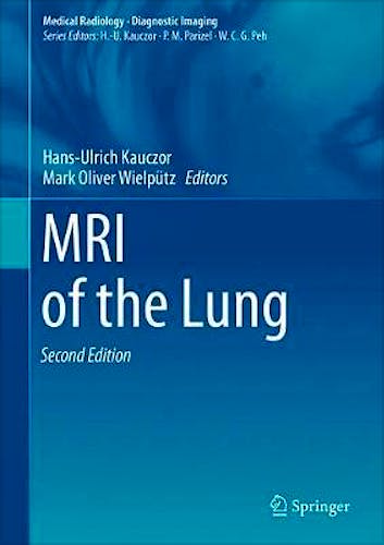 Portada del libro 9783319426167 MRI of the Lung
