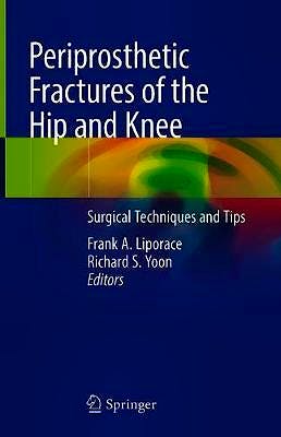 Portada del libro 9783319430072 Periprosthetic Fractures of the Hip and Knee. Surgical Techniques and Tips