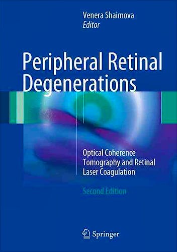 Portada del libro 9783319489940 Peripheral Retinal Degenerations. Optical Coherence Tomography and Retinal Laser Coagulation