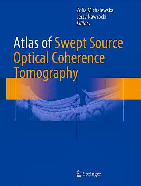 Portada del libro 9783319498393 Atlas of Swept Source Optical Coherence Tomography