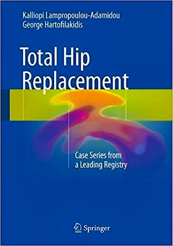 Portada del libro 9783319533599 Total Hip Replacement. Case Series from a Leading Registry