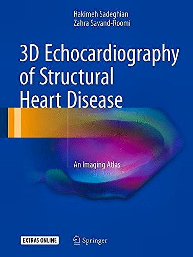 Portada del libro 9783319540382 3d Echocardiography of Structural Heart Disease. an Imaging Atlas