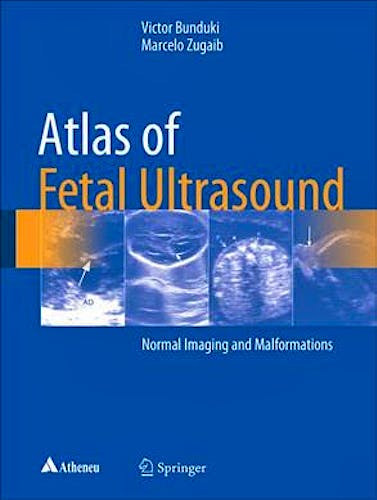 Portada del libro 9783319547978 Atlas of Fetal Ultrasound. Normal Imaging and Malformations