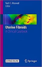 Uterine Fibroids. A Clinical Casebook