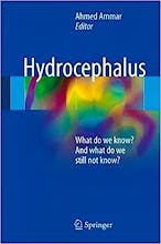 Hydrocephalus. What Do We Know? And What Do We Still Not Know?