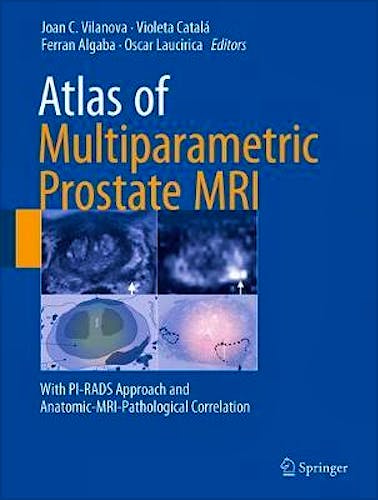 Atlas of Multiparametric Prostate MRI. With PI-RADS Approach and Anatomic-MRI-Pathological Correlation