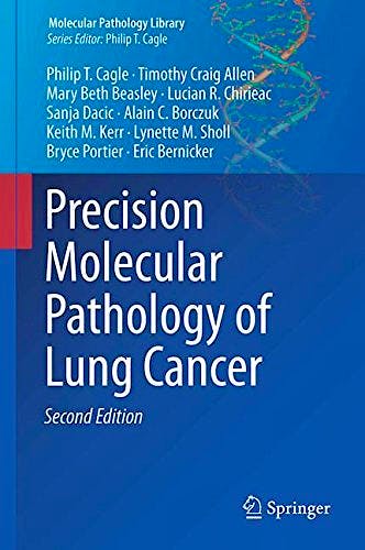 Portada del libro 9783319629407 Precision Molecular Pathology of Lung Cancer (Molecular Pathology Library, Vol. 13) (Hardcover)