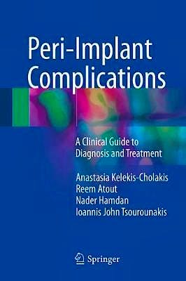 Portada del libro 9783319637174 Peri-Implant Complications. A Clinical Guide to Diagnosis and Treatment