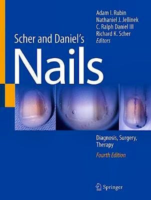 Portada del libro 9783319656472 Scher and Daniel's Nails. Diagnosis, Surgery, Therapy