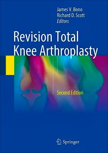 Portada del libro 9783319673424 Revision Total Knee Arthroplasty