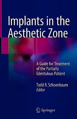 Portada del libro 9783319726007 Implants in the Aesthetic Zone. A Guide for Treatment of the Partially Edentulous Patient
