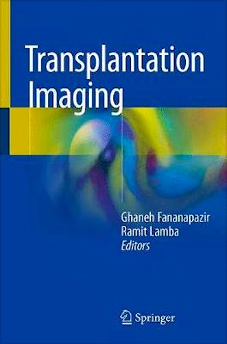Portada del libro 9783319752648 Transplantation Imaging