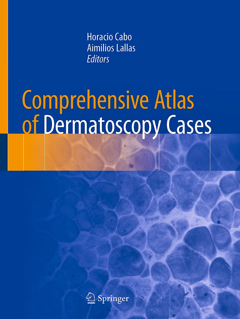 Portada del libro 9783319769318 Comprehensive Atlas of Dermatoscopy Cases