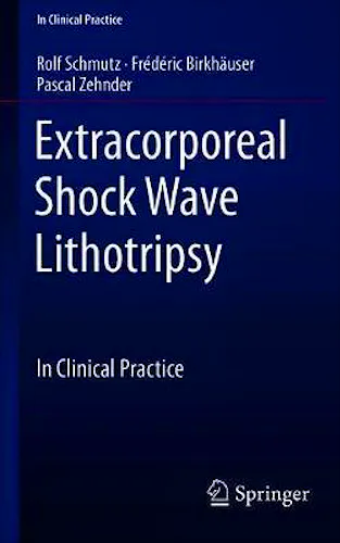 Portada del libro 9783319776392 Extracorporeal Shock Wave Lithotripsy. In Clinical Practice