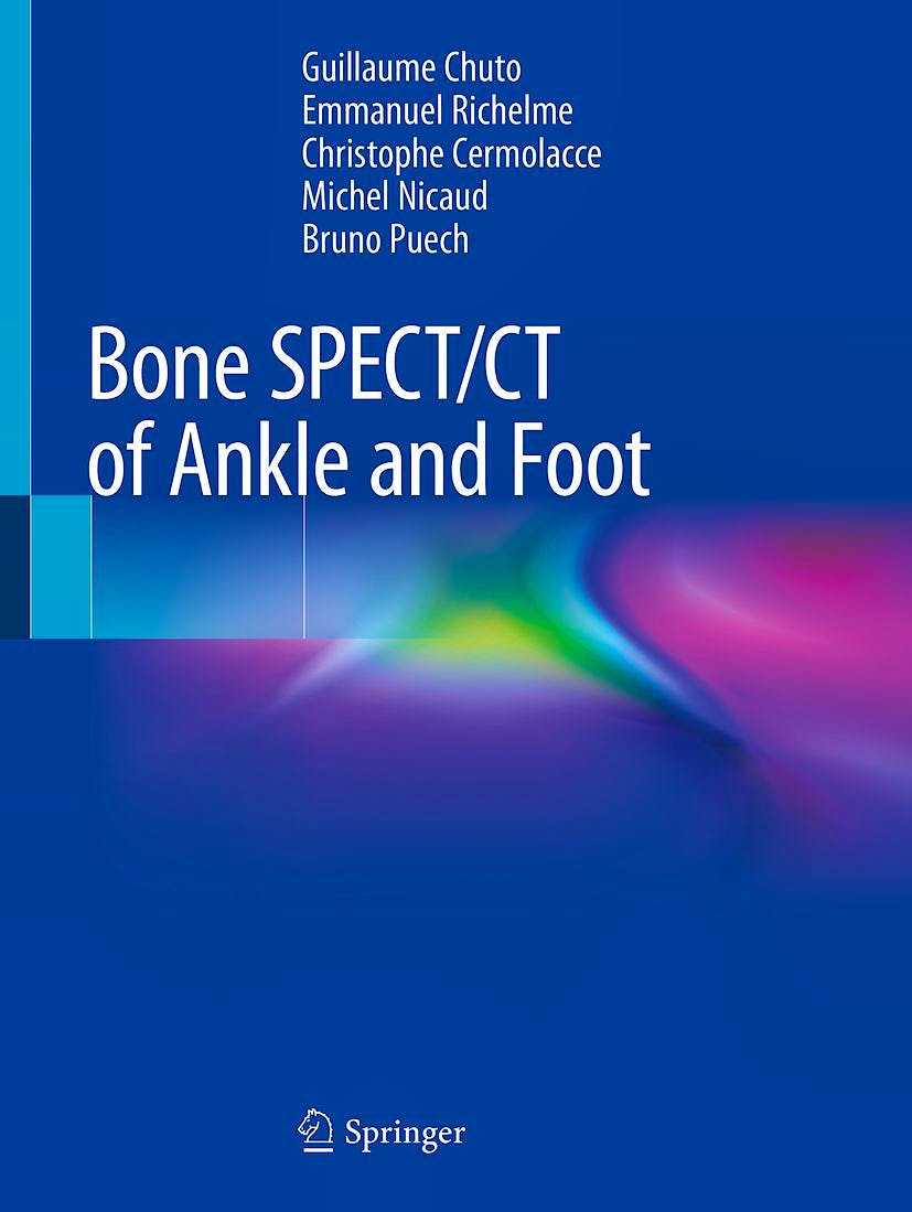 Portada del libro 9783319908106 Bone SPECT/CT of Ankle and Foot