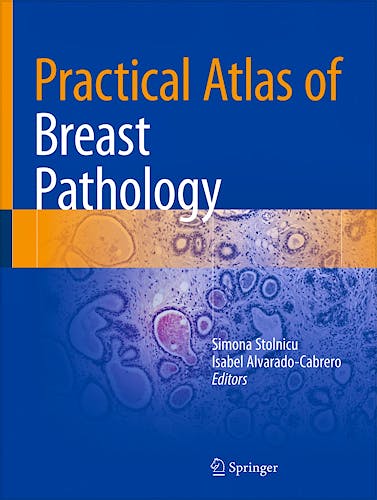 Portada del libro 9783319932569 Practical Atlas of Breast Pathology