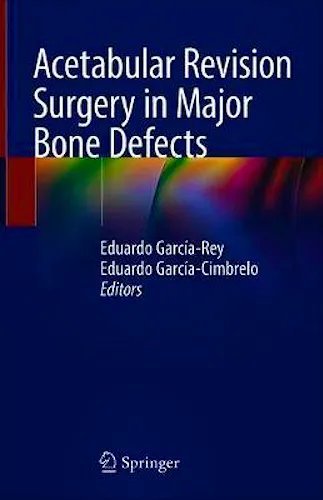 Portada del libro 9783319985954 Acetabular Revision Surgery in Major Bone Defects
